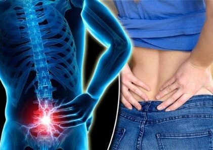 BACK PAIN RELIEF